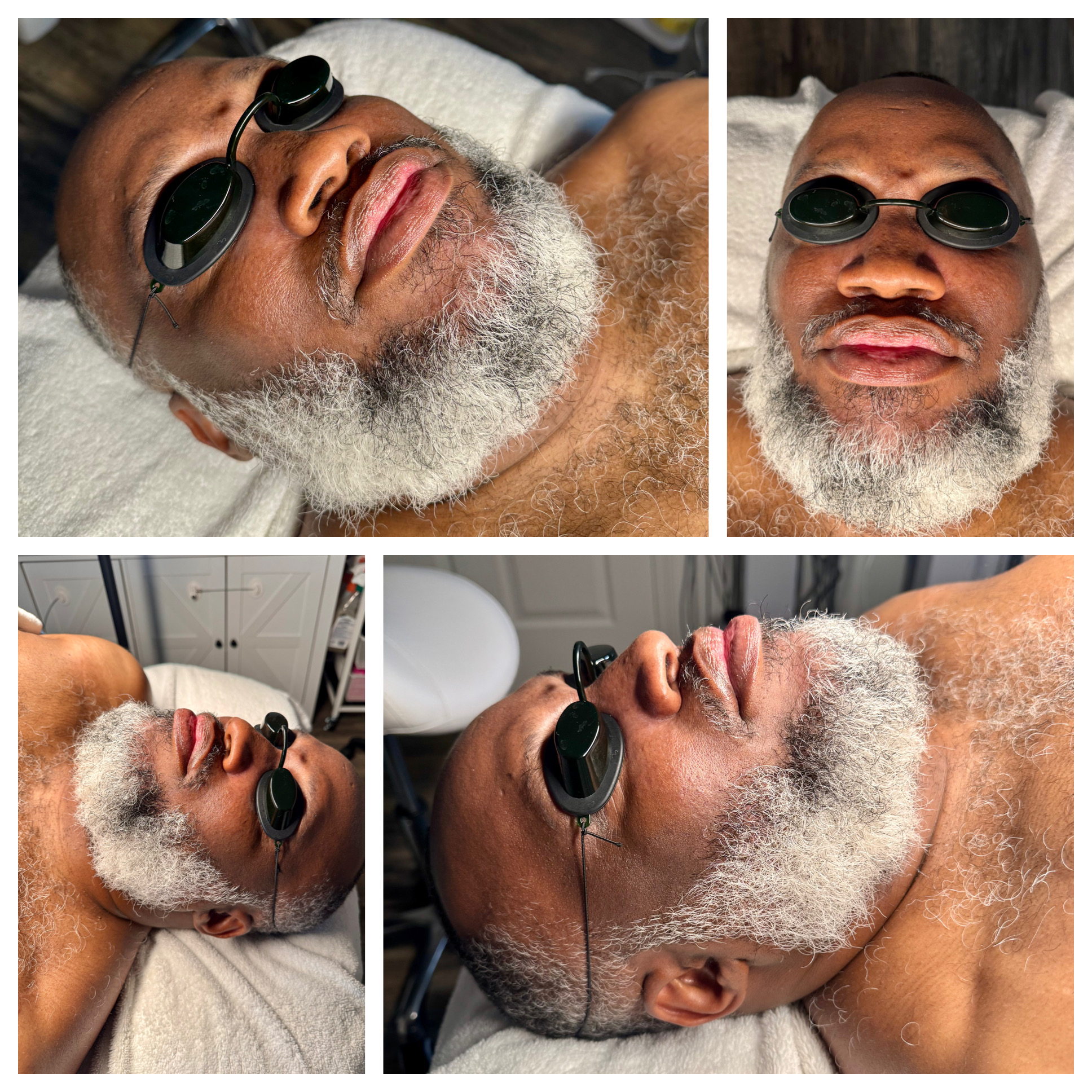 Client results at WilKay Wellness & Aesthetics, Phoenix AZ – photo 2