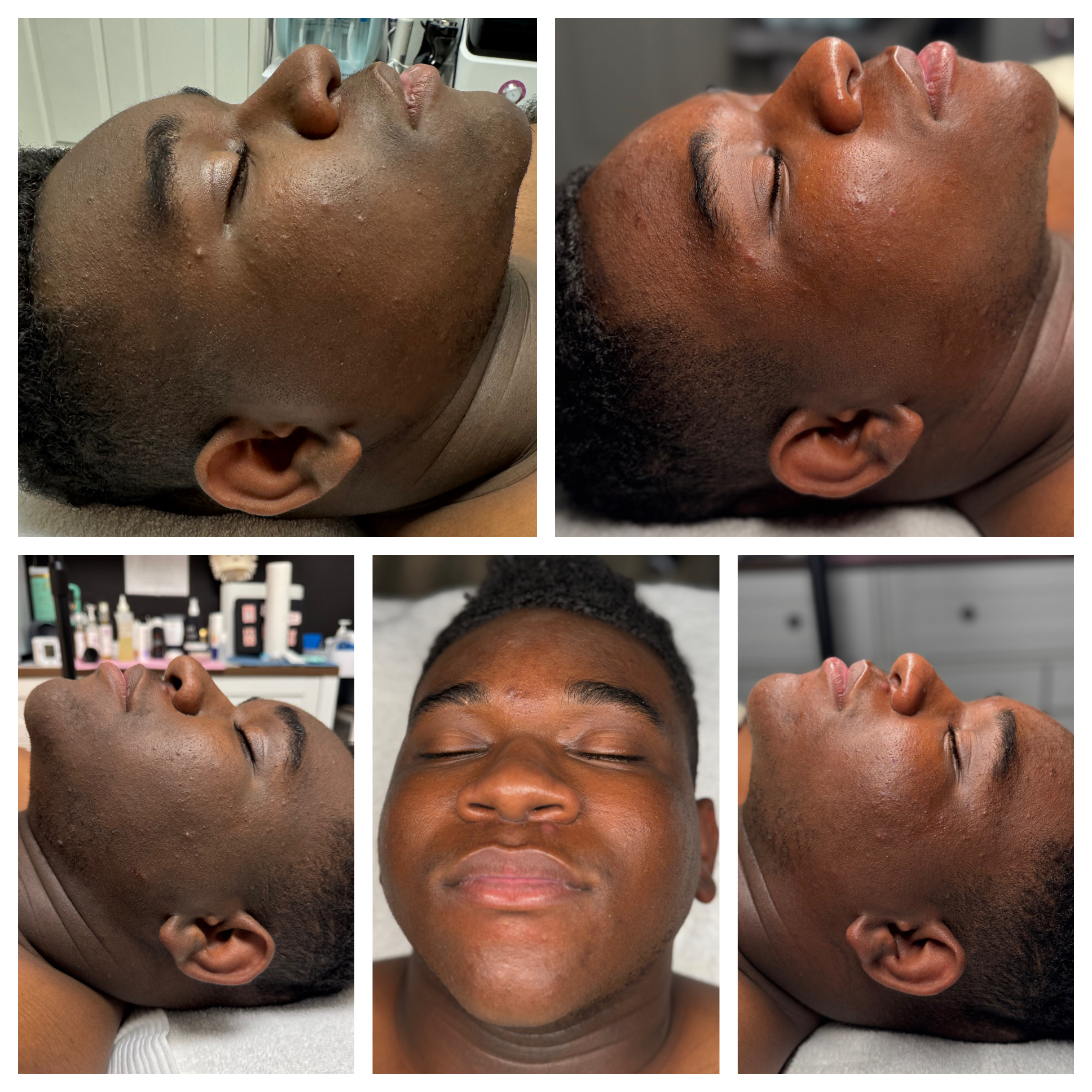 Client results at WilKay Wellness & Aesthetics, Phoenix AZ – photo 3