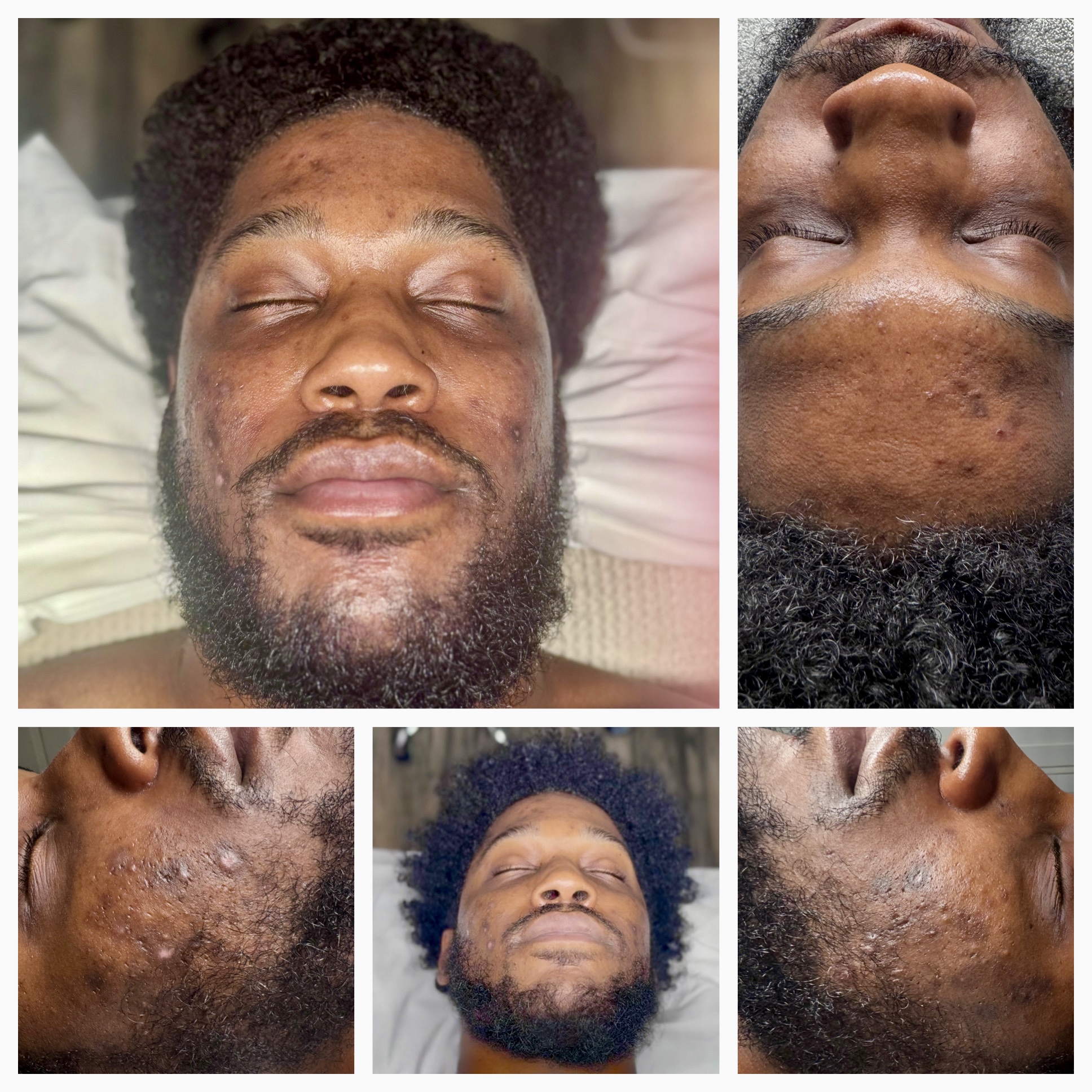 Client results at WilKay Wellness & Aesthetics, Phoenix AZ – photo 5