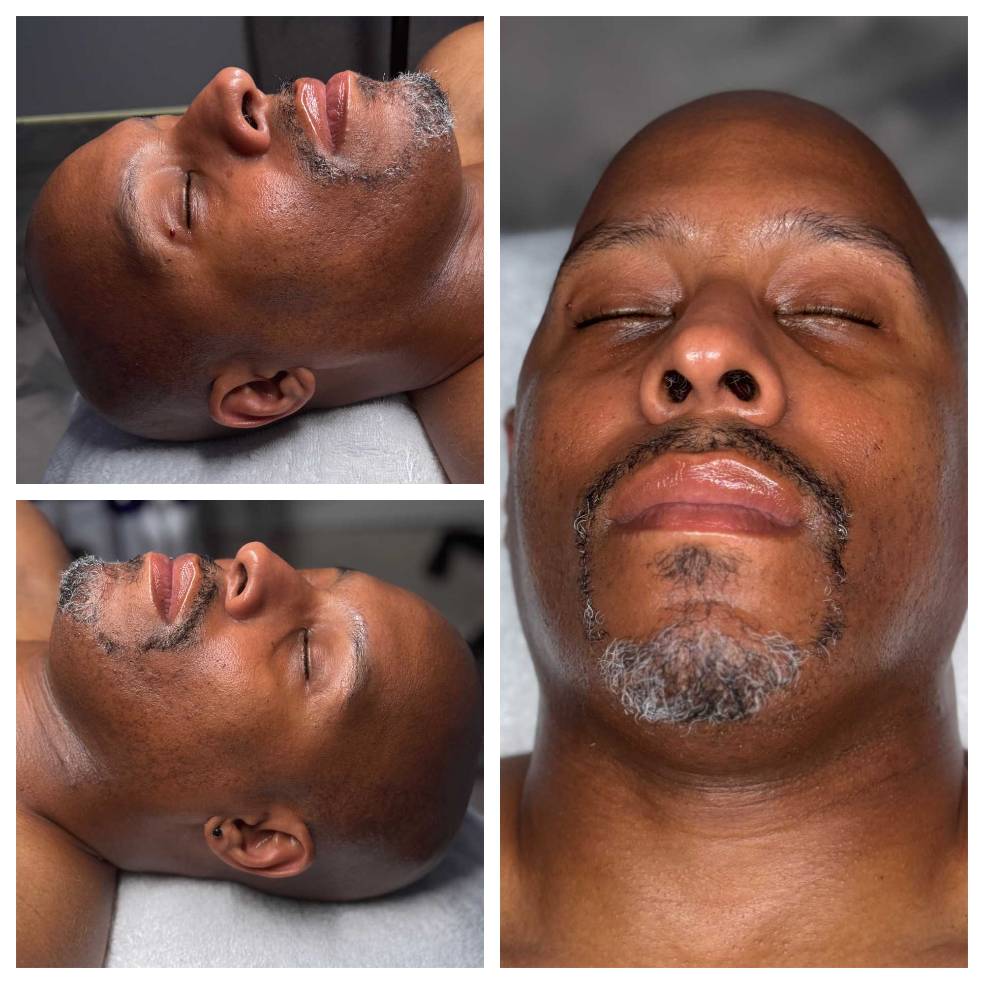 Client results at WilKay Wellness & Aesthetics, Phoenix AZ – photo 6