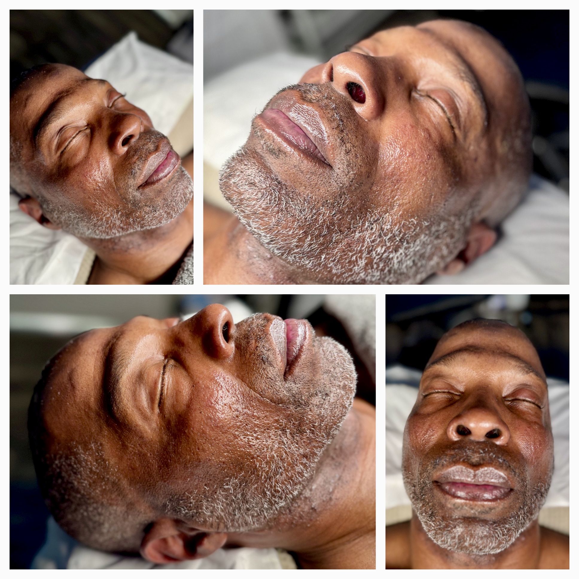 Client results at WilKay Wellness & Aesthetics, Phoenix AZ – photo 7