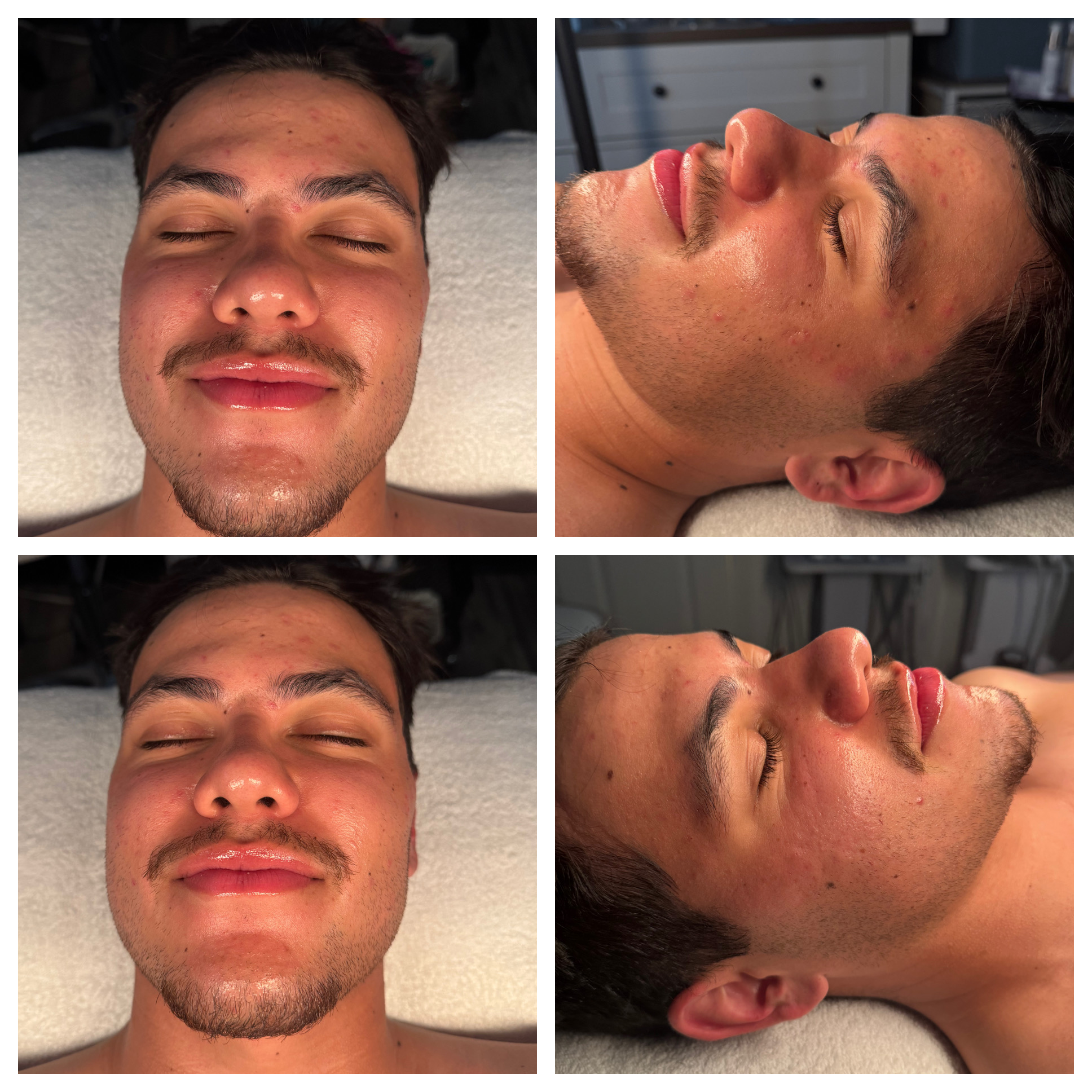 Client results at WilKay Wellness & Aesthetics, Phoenix AZ – photo 8