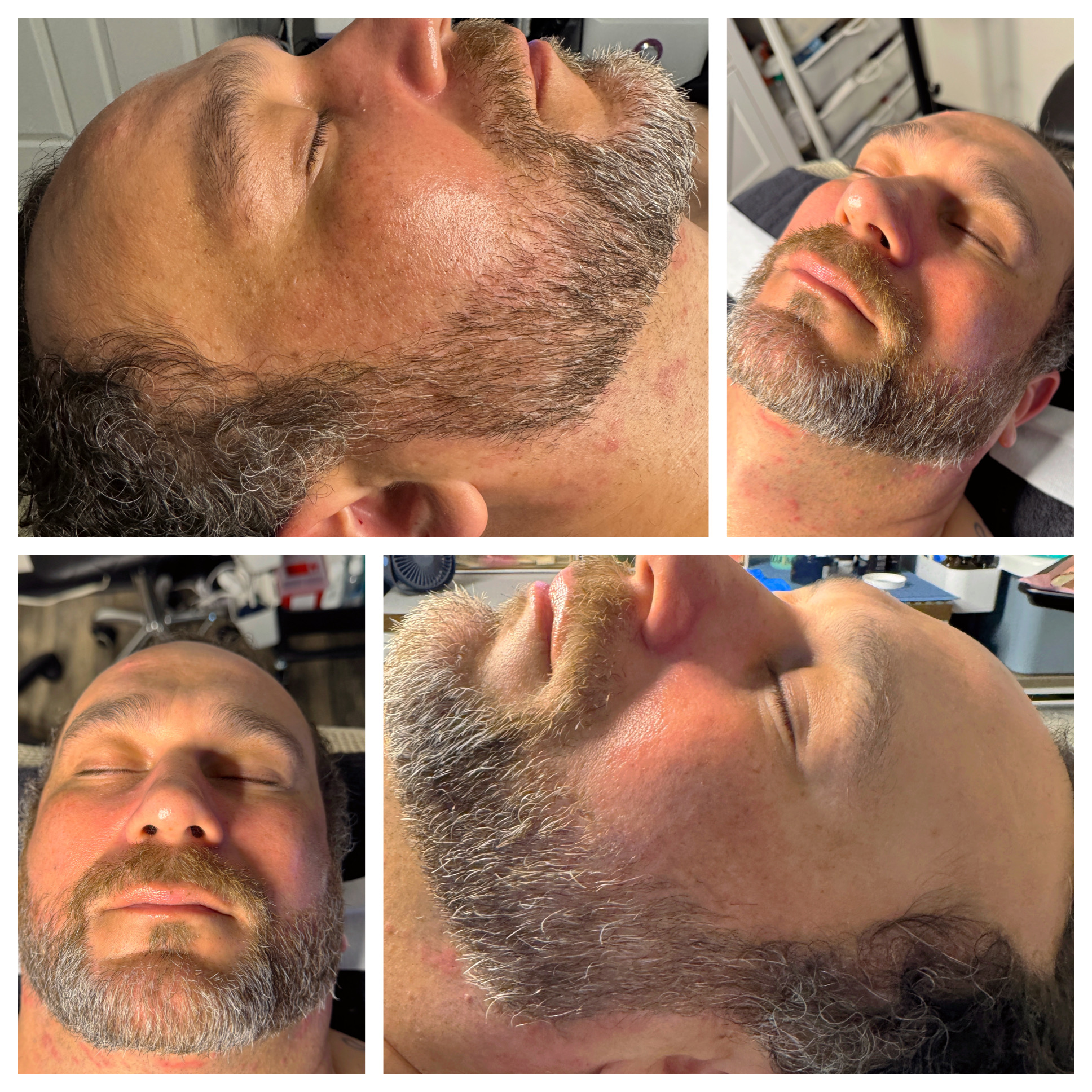 Client results at WilKay Wellness & Aesthetics, Phoenix AZ – photo 12