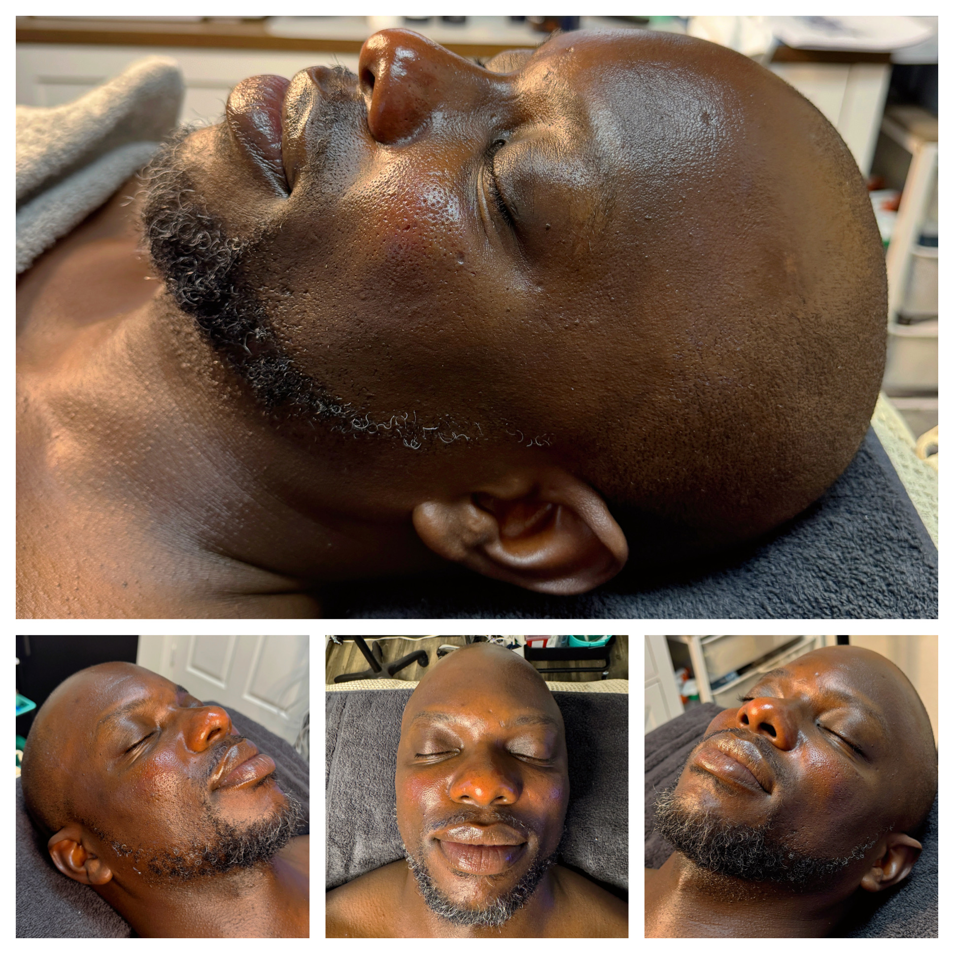Client results at WilKay Wellness & Aesthetics, Phoenix AZ – photo 13