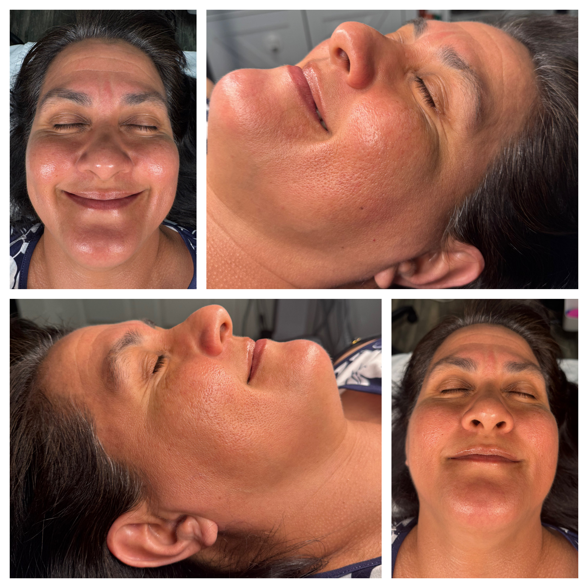 Client results at WilKay Wellness & Aesthetics, Phoenix AZ – photo 17
