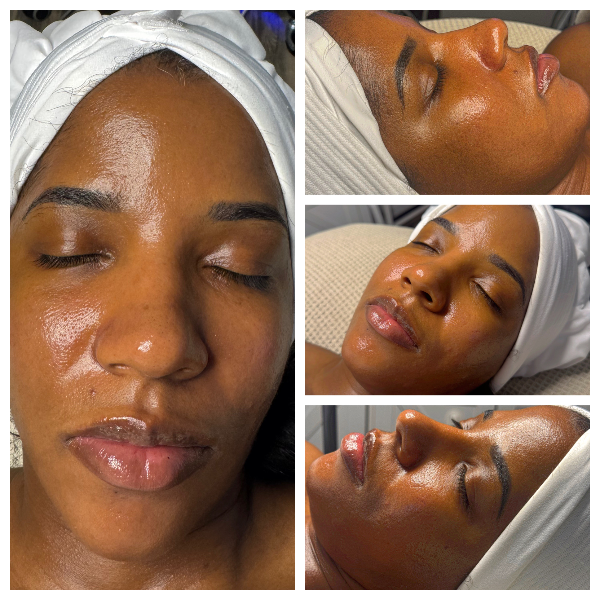 Client results at WilKay Wellness & Aesthetics, Phoenix AZ – photo 23