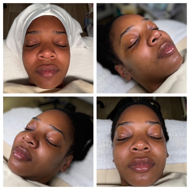 Client results at WilKay Wellness & Aesthetics, Phoenix AZ – photo 40